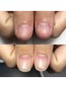 約3ヶ月で爪に自信を◎ 自爪育成ジェル　通常¥10,000