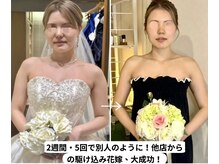 ソウ バイ ソウ(So by 蒼)/[重要]失敗しないサロン選びの為