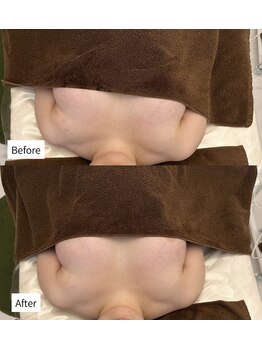 ルメール(Lemaile)/姿勢改善　下垂　バストケア