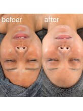 四季ビューティー(四季beauty)/【100%ハーブプーリング】