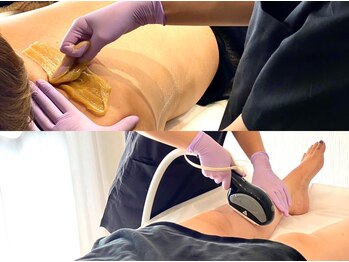 アールス 三軒茶屋(EARLS)の写真/脇/うなじ/顔/VIO…気になるパーツを集中脱毛！黒ずみ・自己処理ザラつき卒業へ！シュガーリング/IPL光脱毛