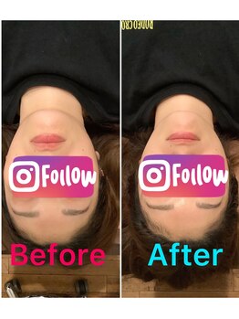 たけ整体院/【小顔矯正＋整体＋EMSパット】