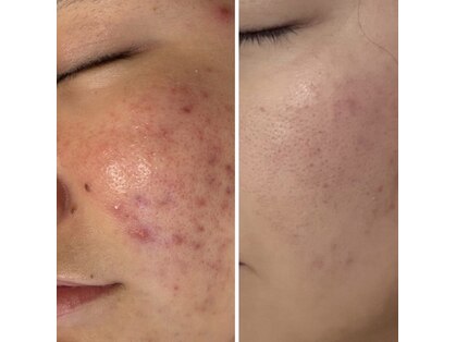 ウル(Ulu)の写真