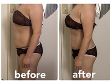 フルール エンビロン(フルール ENVIRON)/理想のバスト　理想のボディ