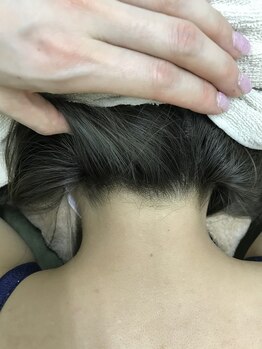 ナノハナ/鹿沼市全身脱毛ナノハナ