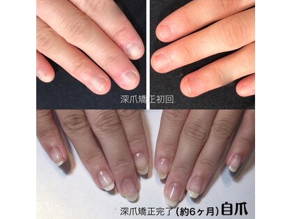 リノール(Linol)の写真