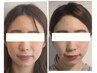 【憧れの小顔美人へ♪】小顔矯正＋小顔ヘッドスパコース ¥16500→¥14000