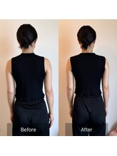 トータルボディケアサロン松濤/骨格矯正フェイシャル