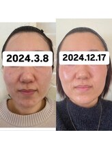 エクラ(Eclat)/《フィシャル》