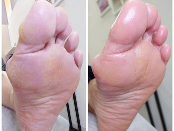 リゼラアンドコー 浦安店/ドイツ式フットケア専門店