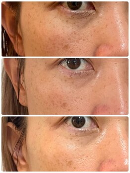 ペリドット(Peridot)/ルナシューネ化粧品をご使用