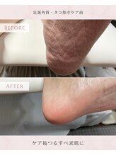 ルミエールサント(lumiere sainte)/足裏角質・タコ集中ケアコース