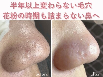 エアル(earu.)の写真