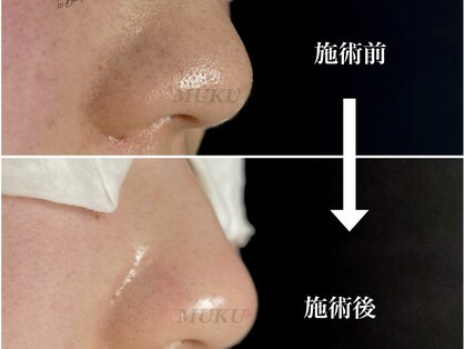 ムク(MUKU)の写真