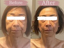 サロン ジジ(salon JiJi)の雰囲気（コルギで小顔に♪即効性抜群！初回と4回目のビフォーアフター★）