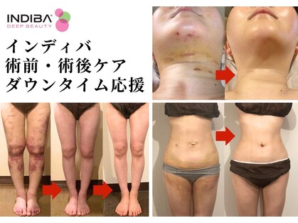 アミュレット(amulette)の写真