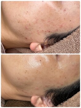 ビーメイクス(B・Makes)/ララピール