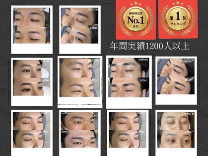 レアファースト by SLAYの写真