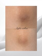 アンフィア(Anfia)/ローマピンク：膝の黒ずみケア