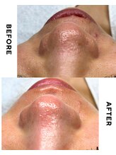 ジーンバイピエル 中野店(gene by PIEL)/#清潔感は肌から！