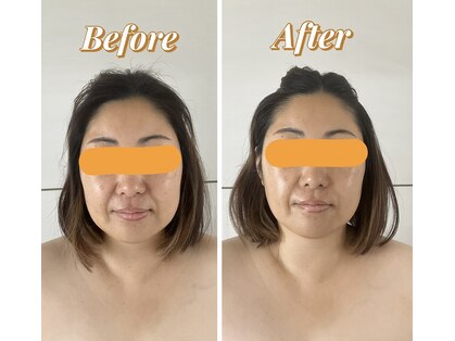 アネラ(Anela)の写真