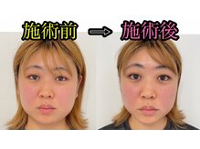 シャルム(Charme)