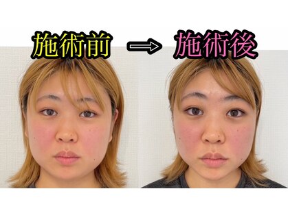 シャルム(Charme)の写真