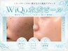 人気No.2【毛穴悩みに】韓国水光ピール+3STEP毛穴洗浄+ヒト幹細胞パック
