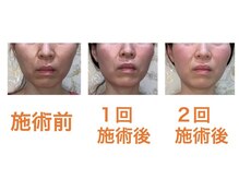 鍼灸サロンオランジュ 高槻富田院/