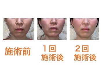 鍼灸サロンオランジュ 高槻富田院/