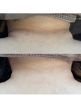 ウルル(ULuLu)/よく見えてしまううなじ!