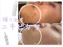 ミー(Me)