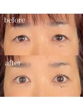 ベルタディドルチェ 立花店(belta di Dolce)/二重のアプローチで10歳巻き戻し