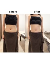 ジョワイユ(Joyeux)/腸の位置でお腹は変わる