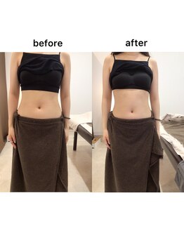 ジョワイユ(Joyeux)/腸の位置でお腹は変わる