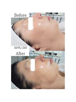 グラシア(gracia)/シミ・毛穴ケア専門店gracia