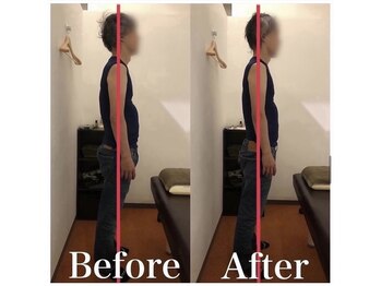 カワル整体 上通り院/呼吸過多が不調の原因です。