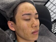 サムライビューティー 渋谷東店(SamuraiBeauty)の雰囲気(メンズフェイシャル♪ハーブピーリングでツルピカお肌へ☆)