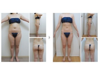 ソフィア ミューズ 目黒/40代以降の痩せにくくなった方