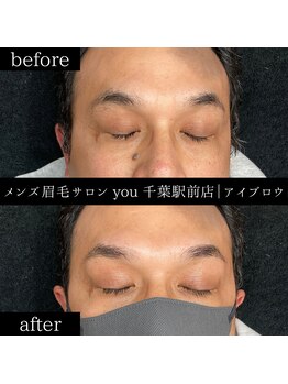 ユー 千葉駅前店(you)/ビフォ-アフター写真