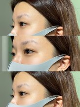 ラーソ(laco)/フラットラッシュ100本