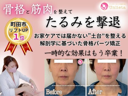 アンリエッタ(Unlieta)の写真