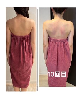 ロココ 錦糸町店(Rococo)/比較写真