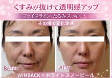 サロンドモモ(SALON de MOMO)