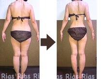 エステティックサロン リアス(Rias)の雰囲気（短期集中ダイエットならリアスにお任せ下さい♪【痩身】）