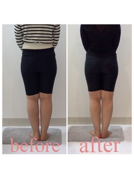 スタイルラボ高松/骨盤矯正の効果♪