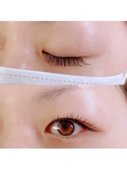 アイクイーン 亀戸(Eyequeen)/