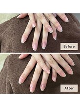 マニュキュア(Manicure)/自信が持てる美しい指先を目指す