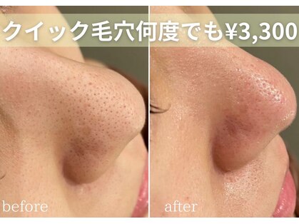 ミエル 神戸店(Miel)の写真