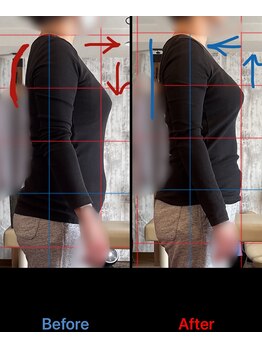 トーラス 整体(TORUS)/猫背改善・バストアップ♪